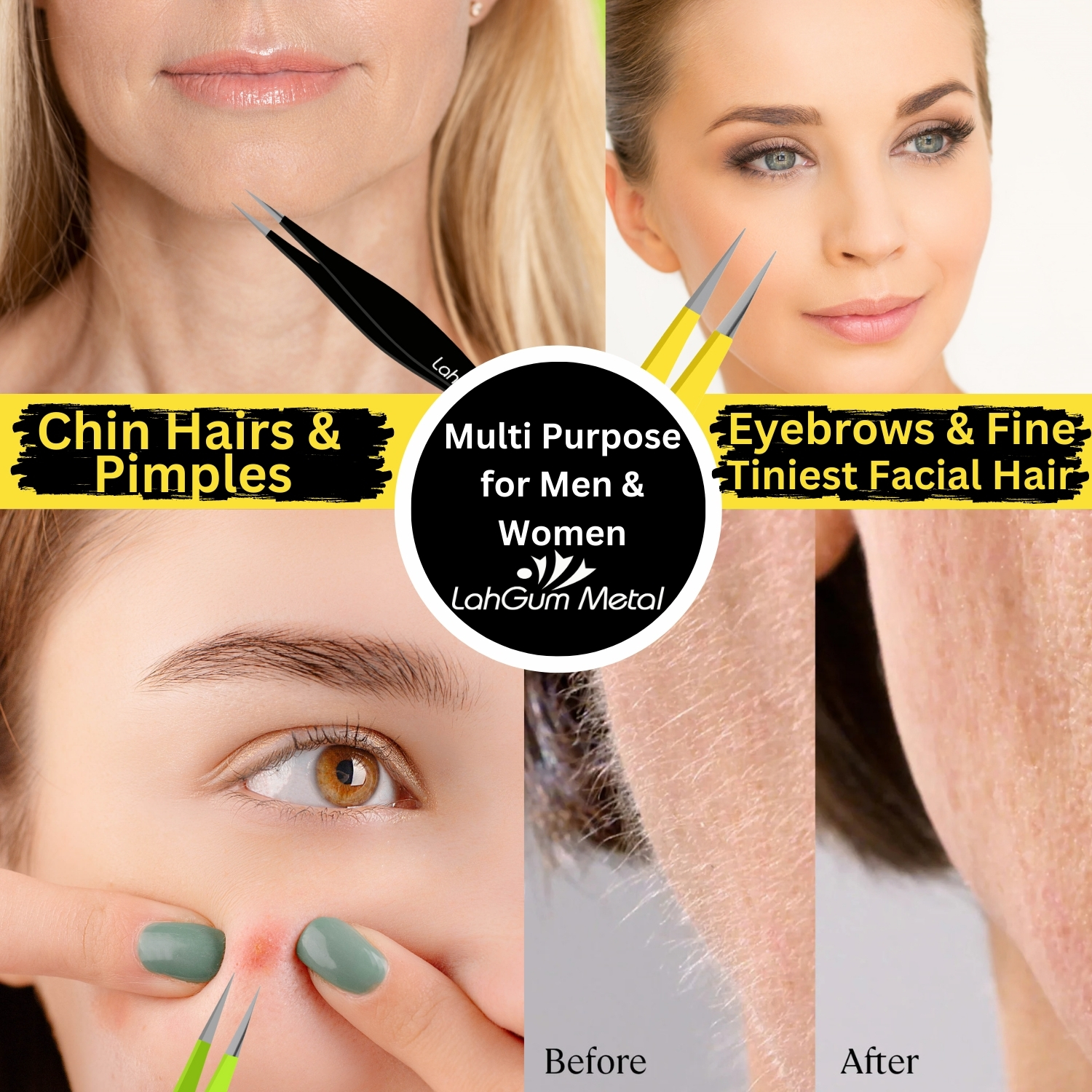 LahGum Metal pointed tweezers for chin hair, eyebrows, pimples and the tiniest facial hairs with precise control.